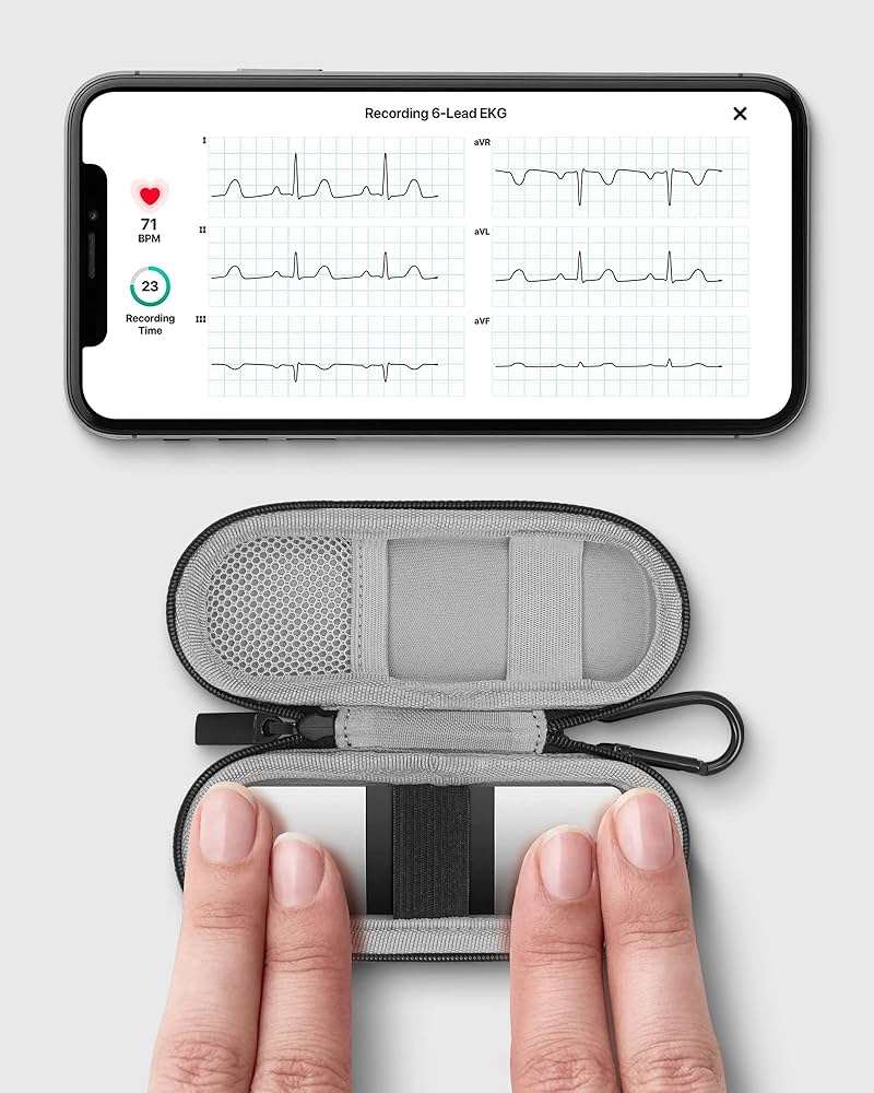 【米国で購入】Kardia Mobile 6L　電子心電図計測デバイス EKG Monitor with 6 Leads | KardiaMobile 6L by AliveCor